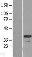 CABP4 Human Over-expression Lysate