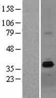 ZDHHC15 Human Over-expression Lysate