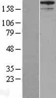 AKAP12 Human Over-expression Lysate