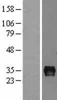 SEPTIN4 Human Over-expression Lysate