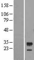 UNC119 binding protein C5orf30 (C5orf30) Human Over-expression Lysate