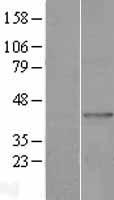 MAG1 (GPAT3) Human Over-expression Lysate