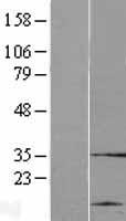CYHR1 Human Over-expression Lysate