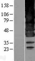 BSCL2 Human Over-expression Lysate