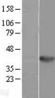 WNT5B Human Over-expression Lysate