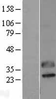 CTRP2 (C1QTNF2) Human Over-expression Lysate