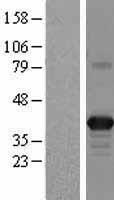 Apolipoprotein L 2 (APOL2) Human Over-expression Lysate