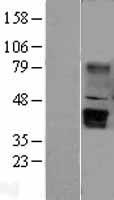 WNT5B Human Over-expression Lysate