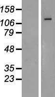 AREB6 (ZEB1) Human Over-expression Lysate