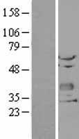 CHODL Human Over-expression Lysate