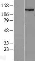 SMC6L1 (SMC6) Human Over-expression Lysate