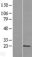 Tumor necrosis factor alpha induced protein 8 like protein 2 (TNFAIP8L2) Human Over-expression Lysate