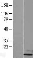 UBL5 Human Over-expression Lysate