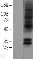 5HT5A receptor (HTR5A) Human Over-expression Lysate
