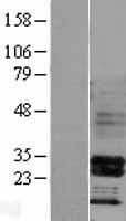 HOXB4 Human Over-expression Lysate