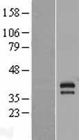 Apoptosis enhancing nuclease (AEN) Human Over-expression Lysate