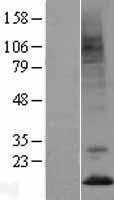 Prokineticin 2 (PROK2) Human Over-expression Lysate