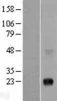 PLAC1 Human Over-expression Lysate