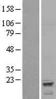 AVPI1 Human Over-expression Lysate