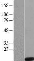 Noxa (PMAIP1) Human Over-expression Lysate