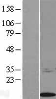 S100 calcium binding protein A14 (S100A14) Human Over-expression Lysate