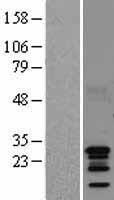 C11orf17 (AKIP1) Human Over-expression Lysate