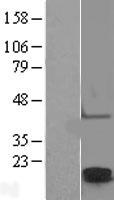 Claudin 2 (CLDN2) Human Over-expression Lysate