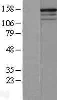 RPGRIP1 Human Over-expression Lysate