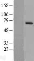 PARP6 Human Over-expression Lysate