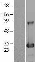 BDH2 Human Over-expression Lysate