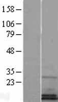 SF20 (MYDGF) Human Over-expression Lysate