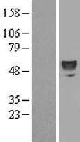 ERO1LB (ERO1B) Human Over-expression Lysate