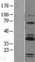 PARP16 Human Over-expression Lysate