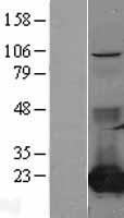 CMPK1 Human Over-expression Lysate
