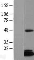 CIAO2B Human Over-expression Lysate