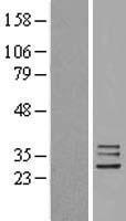 FAM82B (RMDN1) Human Over-expression Lysate