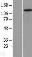 KDM4C Human Over-expression Lysate
