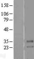 SLC39A2 Human Over-expression Lysate