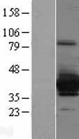 SULT4A1 Human Over-expression Lysate