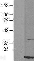ROC1 (RBX1) Human Over-expression Lysate
