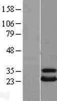 HSPC150 (UBE2T) Human Over-expression Lysate