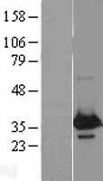 WBP2 Human Over-expression Lysate