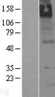 Muscarinic Acetylcholine Receptor M5 (CHRM5) Human Over-expression Lysate