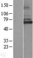 IRAKM (IRAK3) Human Over-expression Lysate