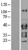 ADRM1 Human Over-expression Lysate
