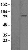 ZNF16 Human Over-expression Lysate