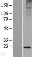 KDELR2 Human Over-expression Lysate