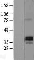 PRSS21 Human Over-expression Lysate