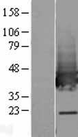 Transaldolase 1 (TALDO1) Human Over-expression Lysate