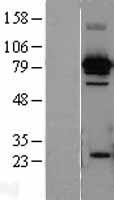 Hsc70 (HSPA8) Human Over-expression Lysate